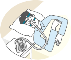 CPAP療法イメージイラスト